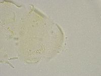 Echiniscus trisetosus image
