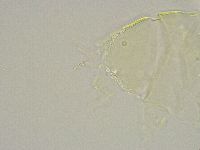 Echiniscus trisetosus image
