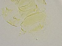 Echiniscus trisetosus image