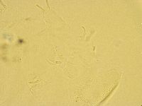 Echiniscus trisetosus image