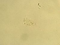 Echiniscus trisetosus image