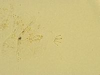 Echiniscus trisetosus image