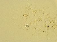 Echiniscus trisetosus image