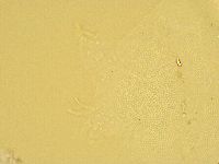 Echiniscus trisetosus image