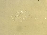 Echiniscus trisetosus image