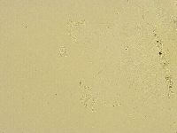 Echiniscus trisetosus image