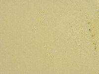 Echiniscus trisetosus image