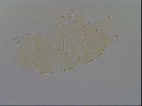 Echiniscus trisetosus image