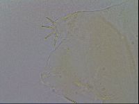 Echiniscus trisetosus image