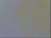 Echiniscus trisetosus image