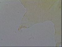 Echiniscus trisetosus image