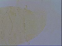 Echiniscus trisetosus image