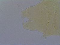 Echiniscus trisetosus image