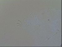Echiniscus trisetosus image