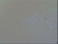 Echiniscus trisetosus image