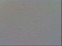Ramazzottius oberhaeuseri image
