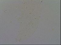 Ramazzottius oberhaeuseri image