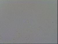 Ramazzottius oberhaeuseri image