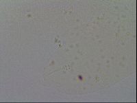 Ramazzottius oberhaeuseri image