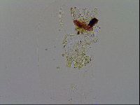 Ramazzottius oberhaeuseri image