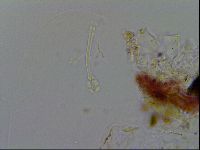 Ramazzottius oberhaeuseri image