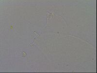 Ramazzottius oberhaeuseri image