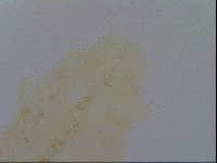 Ramazzottius oberhaeuseri image