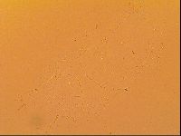 Echiniscus velaminis image