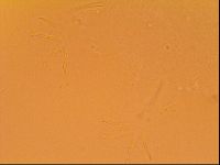 Echiniscus velaminis image
