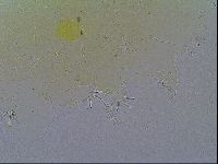 Echiniscus velaminis image
