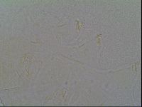 Echiniscus vinculus image