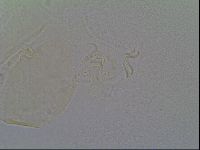 Echiniscus vinculus image
