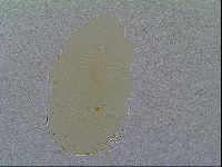Echiniscus vinculus image