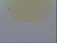 Echiniscus vinculus image