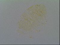 Echiniscus vinculus image