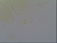 Echiniscus vinculus image