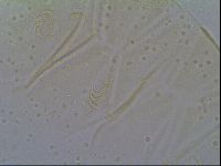 Echiniscus vinculus image