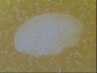 Echiniscus vinculus image