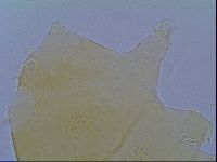 Echiniscus virginicus image
