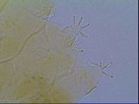 Echiniscus virginicus image