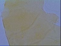 Echiniscus virginicus image