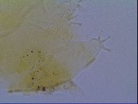 Echiniscus virginicus image