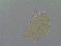 Echiniscus virginicus image
