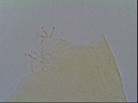 Echiniscus virginicus image