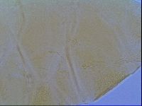Echiniscus virginicus image