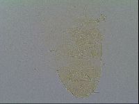 Echiniscus virginicus image