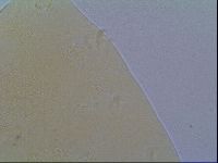 Echiniscus virginicus image