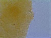 Echiniscus virginicus image