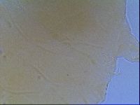 Echiniscus virginicus image