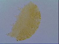 Echiniscus virginicus image
